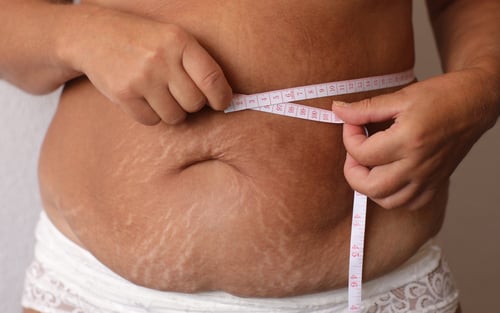 Postpartum Body Kindness Without Comparison